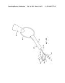 Knee Prosthesis Assembly With Ligament Link diagram and image