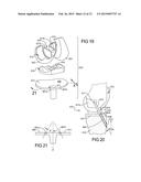 Knee Prosthesis Assembly With Ligament Link diagram and image