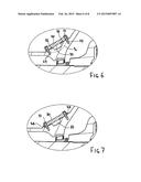 AXLE ASSEMBLY HOUSING diagram and image