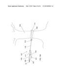 ZIP LINE APPARATUS diagram and image