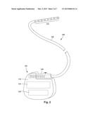 SYSTEMS AND METHODS FOR FORMING AN END OF AN ELONGATED MEMBER OF AN     ELECTRICAL STIMULATION SYSTEM diagram and image