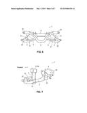 SUSPENSION DEVICE OF VEHICLE diagram and image