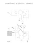 Lining Part for Mounting on a Vehicle Body Part with an Airbag Module,     Airbag System with a Body Part and with Such a Lining Part and Method for     the Production of the Lining Part diagram and image