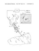 Video System For Viewing An Object On A Body diagram and image