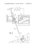 Video System For Viewing An Object On A Body diagram and image