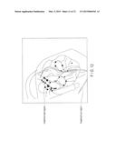 X-RAY IMAGE PROCESSING APPARATUS, X-RAY DIAGNOSTIC APPARATUS, AND X-RAY     IMAGE PROCESSING METHOD diagram and image