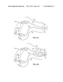 METHOD OF PERFORMING AN RECD MEASUREMENT USING A HEARING ASSISTANCE DEVICE diagram and image