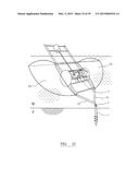 MOORING DEVICE diagram and image