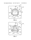 ELASTICALLY DEFORMABLE ALIGNMENT FASTENER AND SYSTEM diagram and image