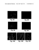 NEUROPHILIC NANOPARTICLES diagram and image