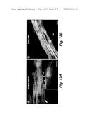 NEUROPHILIC NANOPARTICLES diagram and image