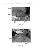 METHODS AND USES OF BIOLOGICAL TISSUES FOR VARIOUS STENT AND OTHER MEDICAL     APPLICATIONS diagram and image