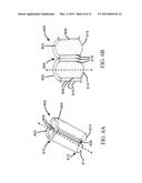 METHODS AND USES OF BIOLOGICAL TISSUES FOR VARIOUS STENT AND OTHER MEDICAL     APPLICATIONS diagram and image