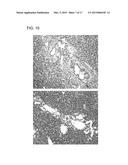 FIBROSIS SUPPRESSION BY INHIBITING INTEGRIN ALPHA-8 BETA-1 FUNCTION diagram and image