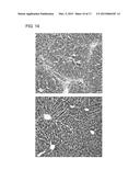 FIBROSIS SUPPRESSION BY INHIBITING INTEGRIN ALPHA-8 BETA-1 FUNCTION diagram and image