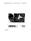 METHODS OF TREATING CANCER HAVING AN ACTIVE WNT/BETA-CATENIN PATHWAY diagram and image