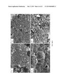 SURFACES HAVING NANOPARTICULATE LAYERS AND ASSEMBLY AND USE THEREOF diagram and image