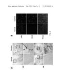 COMPOSITION FOR PROPHYLAXIS OR TREATMENT OF VASCULAR OR CARDIAC VALVULAR     CALCIFICATION COMPRISING DIPEPTIDYL PEPTIDASE-4 INHIBITOR diagram and image