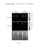 COMPOSITION FOR PROPHYLAXIS OR TREATMENT OF VASCULAR OR CARDIAC VALVULAR     CALCIFICATION COMPRISING DIPEPTIDYL PEPTIDASE-4 INHIBITOR diagram and image