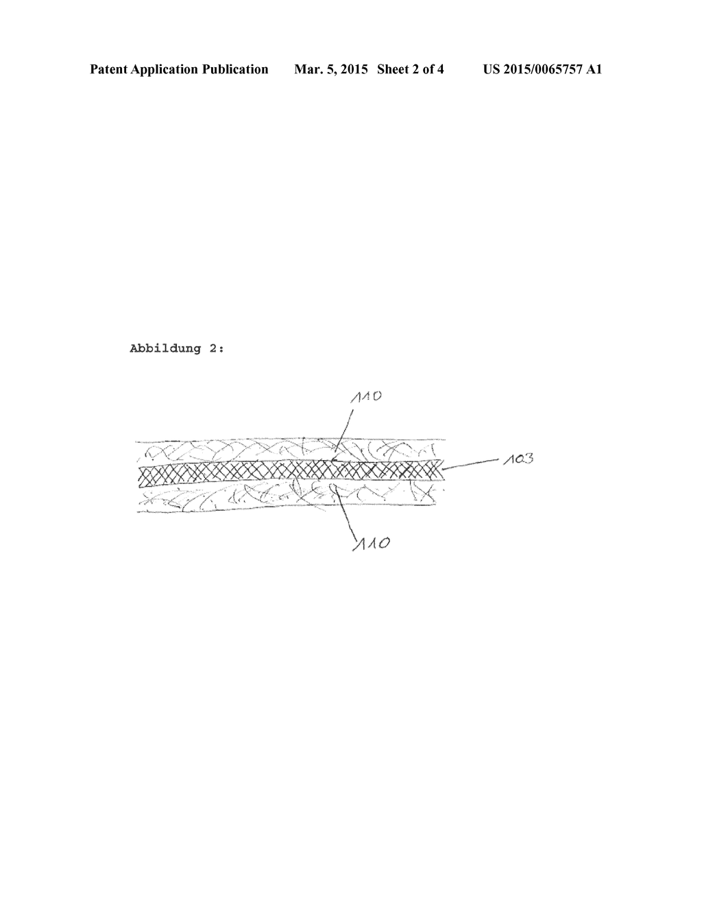 COMPOSITE MATERIAL COMPOSED OF A POLYMER CONTAINING FLUORINE, HYDROPHOBIC     ZEOLITE PARTICLES AND A METAL MATERIAL - diagram, schematic, and image 03