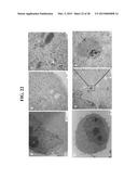 CORE-SATELLITE NANOCOMPOSITES FOR MRI AND PHOTOTHERMAL THERAPY diagram and image