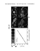 CORE-SATELLITE NANOCOMPOSITES FOR MRI AND PHOTOTHERMAL THERAPY diagram and image