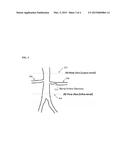 Method and System for Functional Assessment of Renal Artery Stenosis from     Medical Images diagram and image