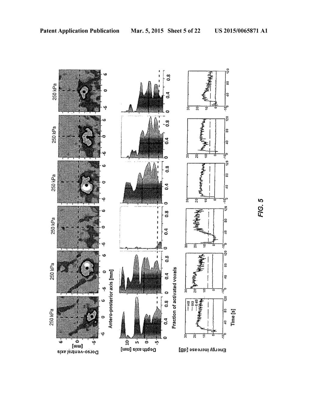 SYSTEMS AND METHODS FOR REAL-TIME, TRANSCRANIAL MONITORING OF BLOOD-BRAIN     BARRIER OPENING - diagram, schematic, and image 06