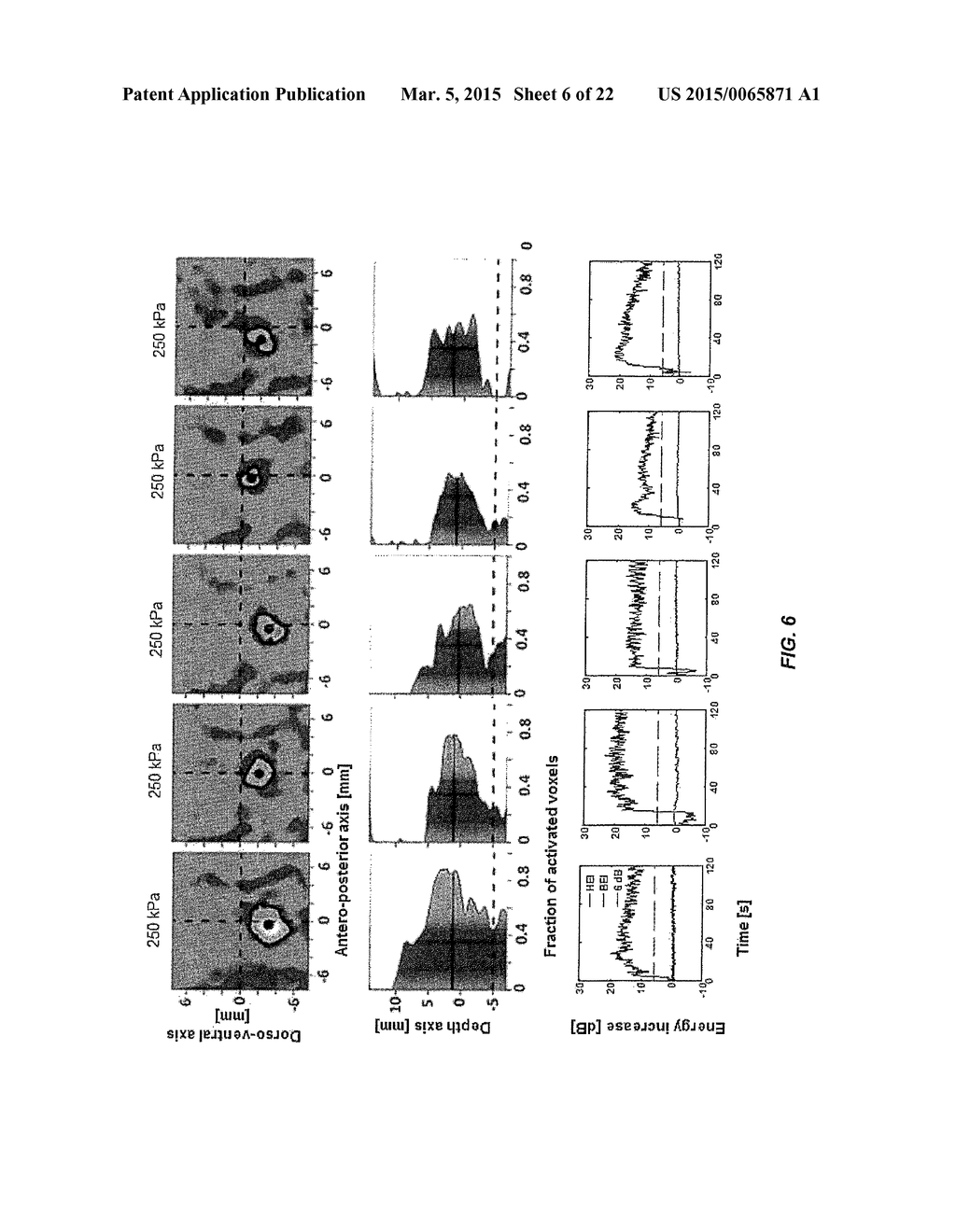 SYSTEMS AND METHODS FOR REAL-TIME, TRANSCRANIAL MONITORING OF BLOOD-BRAIN     BARRIER OPENING - diagram, schematic, and image 07