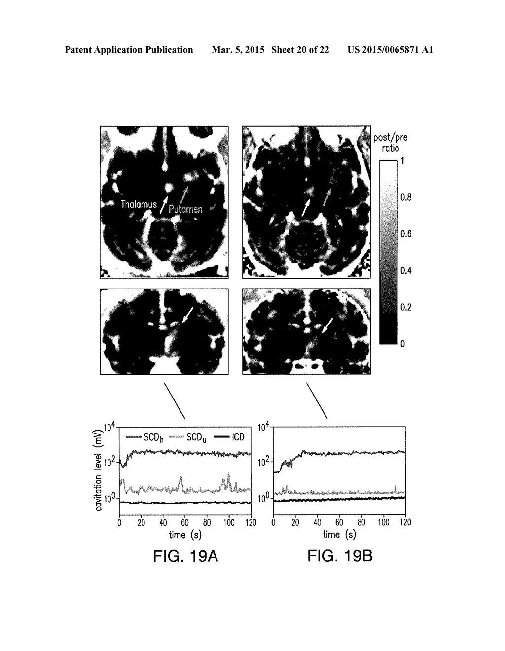 SYSTEMS AND METHODS FOR REAL-TIME, TRANSCRANIAL MONITORING OF BLOOD-BRAIN     BARRIER OPENING - diagram, schematic, and image 21