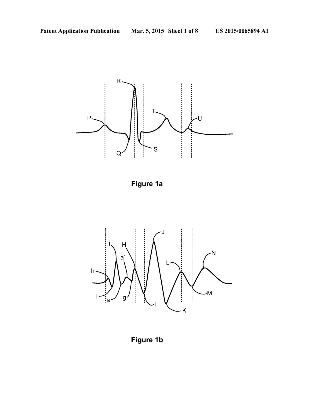 METHOD AND APPARATUS FOR DETERMINING INFORMATION INDICATIVE OF CARDIAC     MALFUNCTIONS AND ABNORMALITIES - diagram, schematic, and image 02