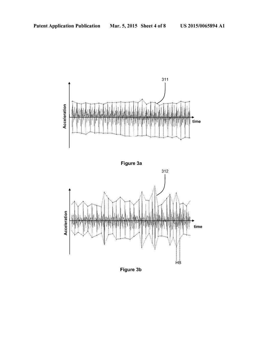 METHOD AND APPARATUS FOR DETERMINING INFORMATION INDICATIVE OF CARDIAC     MALFUNCTIONS AND ABNORMALITIES - diagram, schematic, and image 05