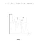 METHOD AND APPARATUS FOR DETERMINING INFORMATION INDICATIVE OF CARDIAC     MALFUNCTIONS AND ABNORMALITIES diagram and image