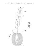 INSERTABLE ENDOSCOPIC INSTRUMENT FOR TISSUE REMOVAL diagram and image