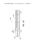 INSERTABLE ENDOSCOPIC INSTRUMENT FOR TISSUE REMOVAL diagram and image