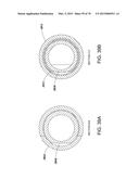 INSERTABLE ENDOSCOPIC INSTRUMENT FOR TISSUE REMOVAL diagram and image