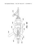 INSERTABLE ENDOSCOPIC INSTRUMENT FOR TISSUE REMOVAL diagram and image