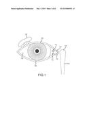 IMPLANTATION TOOLS, TOOL ASSEMBLIES, KITS AND METHODS diagram and image