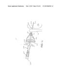 IMPLANTATION TOOLS, TOOL ASSEMBLIES, KITS AND METHODS diagram and image