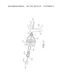 IMPLANTATION TOOLS, TOOL ASSEMBLIES, KITS AND METHODS diagram and image