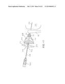 IMPLANTATION TOOLS, TOOL ASSEMBLIES, KITS AND METHODS diagram and image