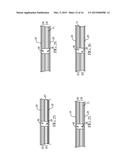 Absorbent Articles With Channels diagram and image