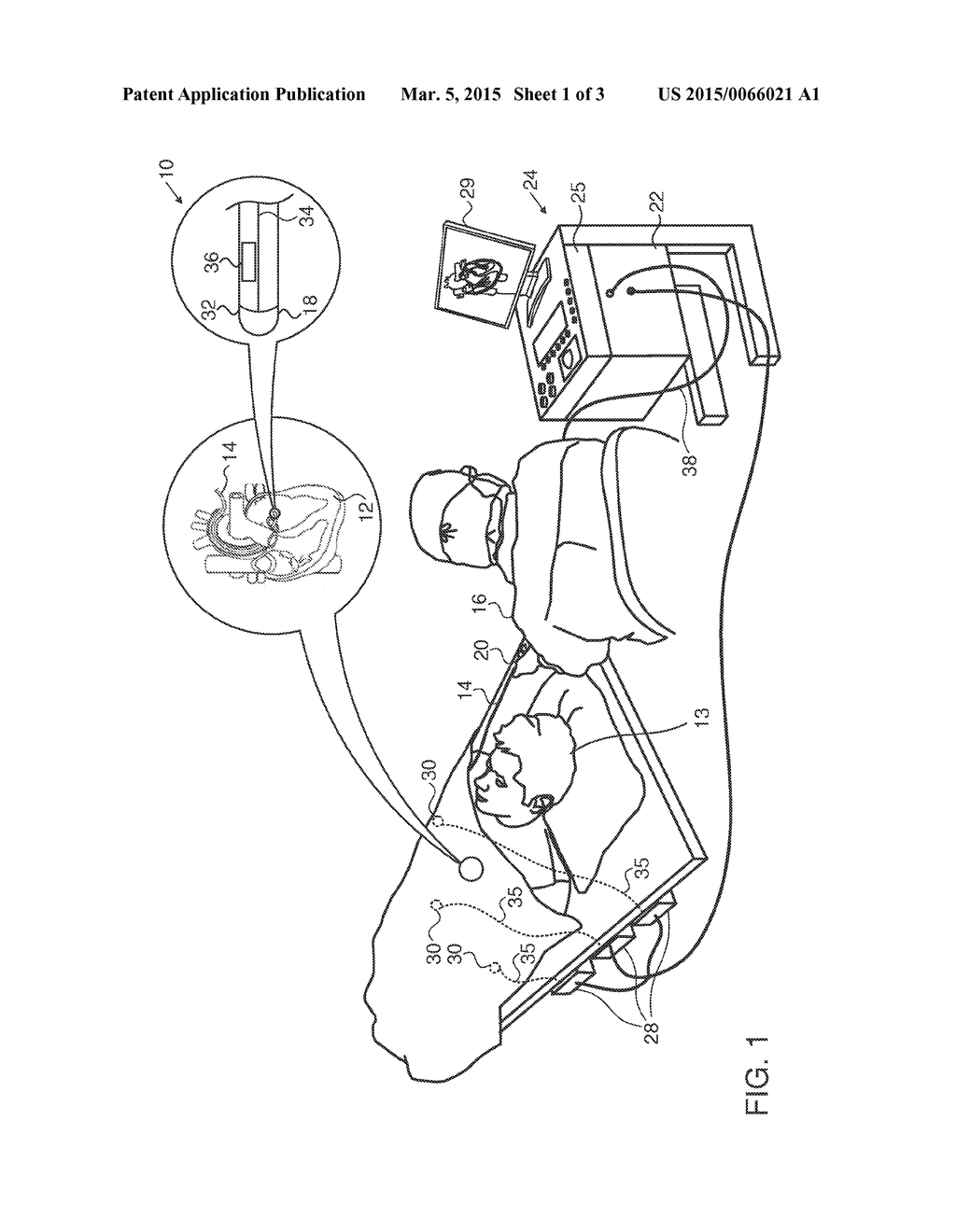 DETERMINING ABSENCE OF CONTACT FOR A CATHETER - diagram, schematic, and image 02