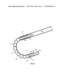 METHOD AND APPARATUS FOR PERFORMING MINIMALLY INVASIVE ARTHROSCOPIC     PROCEDURES diagram and image