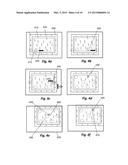 Methods and Systems for Directing Movement of a Tool in Hair     Transplantation Procedures diagram and image