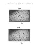 Methods and Systems for Directing Movement of a Tool in Hair     Transplantation Procedures diagram and image