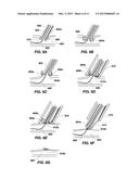 REDUNDANT TISSUE CLOSURE METHODS AND APPARATUSES diagram and image