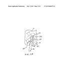 INTRODUCER SHEATH WITH EMBOLIC PROTECTION diagram and image