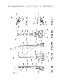 SYSTEMS AND METHODS FOR USING POLYAXIAL PLATES diagram and image