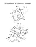 CERVICAL PLATE WITH A FEEDBACK DEVICE FOR SELECTIVE ASSOCIATION WITH BONE     SCREW BLOCKING MECHANISM diagram and image